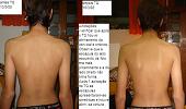 Change in Body Alignment
