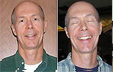 The Quantum Smile